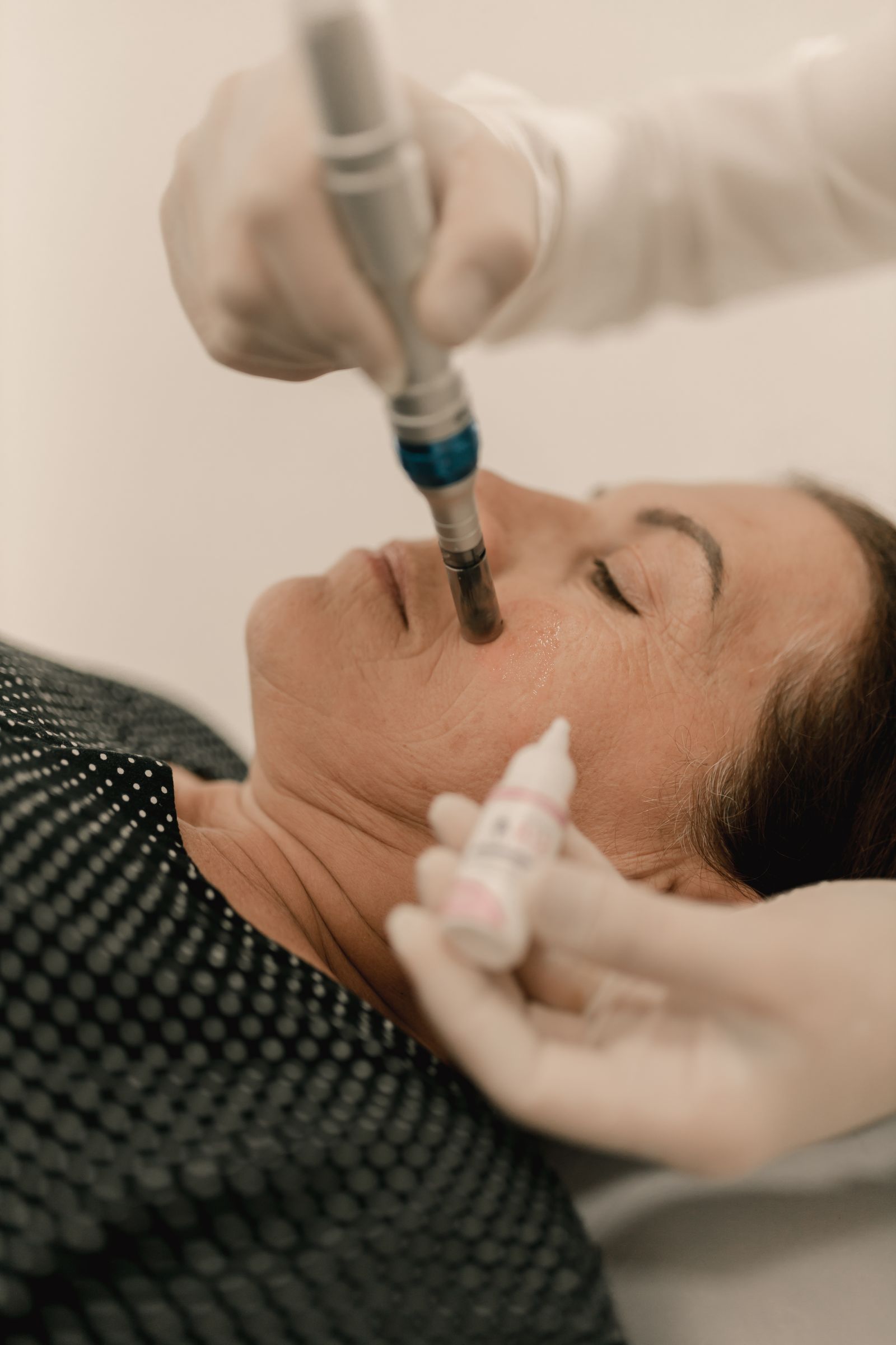 A microdermabrasion treatment in progress